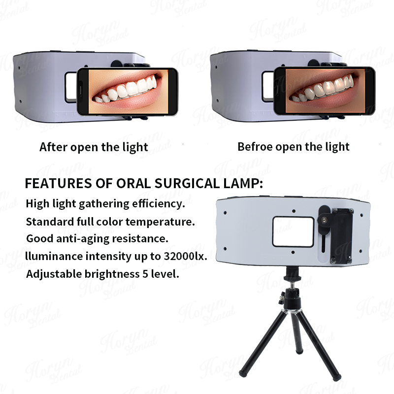 치과 플래시 라이트 사진 장비 치과 LED 구강 충전  - Photography Lighting Led 리뷰 및 가격
